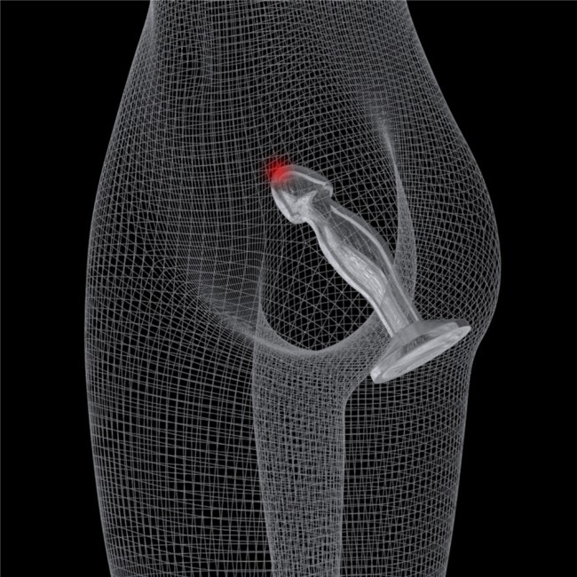 Прозрачный стимулятор простаты на присоске «Flawless Clear Prostate Plug 6.5» от «Lovetoy» Прозрачный стимулятор простаты на присоске «Flawless Clear Prostate Plug 6.5» от «Lovetoy»